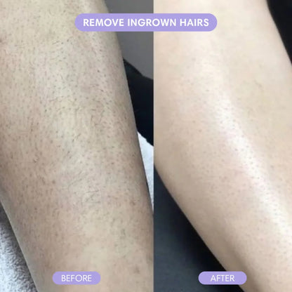 SilkSmooth™ — Body Hair Removal Spray