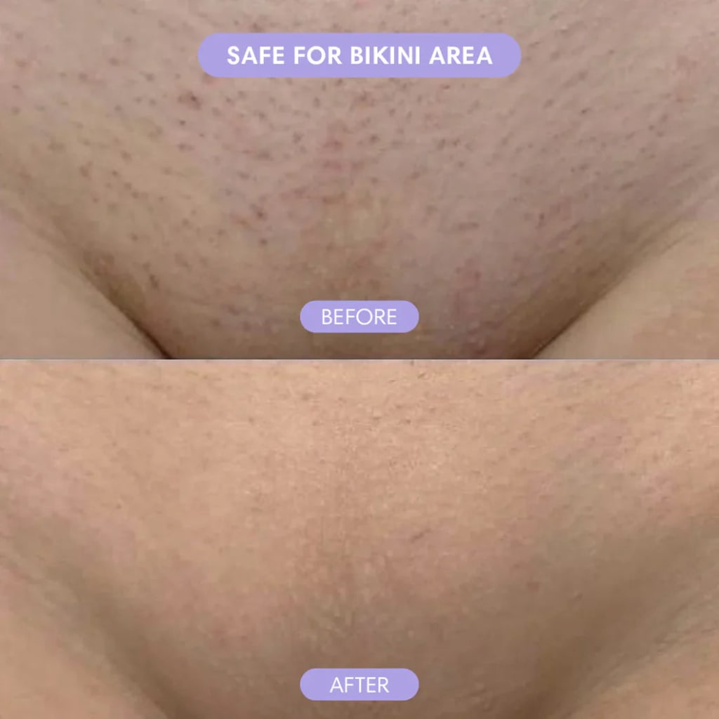 SilkSmooth™ — Body Hair Removal Spray