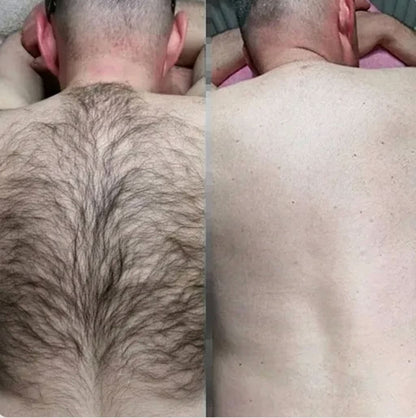 SilkSmooth™ — Body Hair Removal Spray