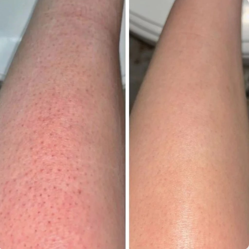 SilkSmooth™ — Body Hair Removal Spray