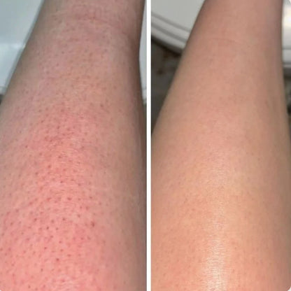 SilkSmooth™ — Body Hair Removal Spray