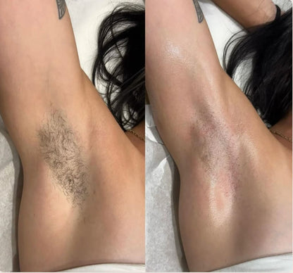 SilkSmooth™ — Body Hair Removal Spray