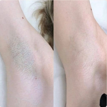 SilkSmooth™ — Body Hair Removal Spray