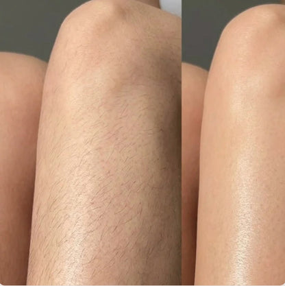 SilkSmooth™ — Body Hair Removal Spray
