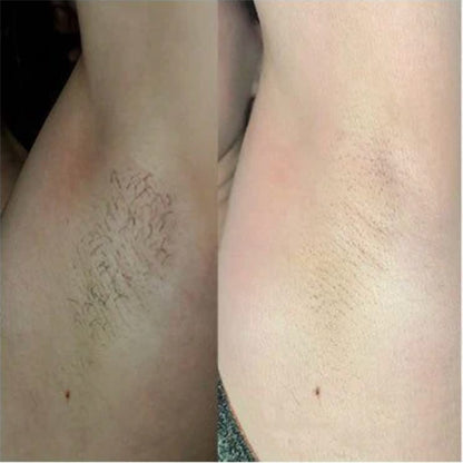 SilkSmooth™ — Body Hair Removal Spray