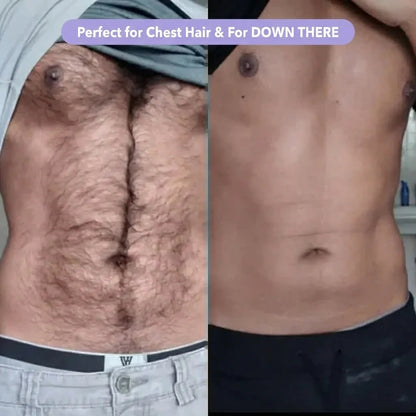 SilkSmooth™ — Body Hair Removal Spray
